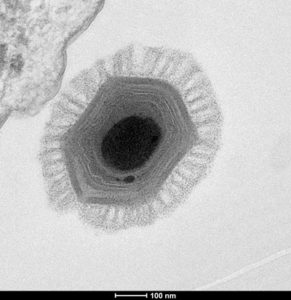 Scientists discover 30,000-year-old giant virus in Siberia - The ...