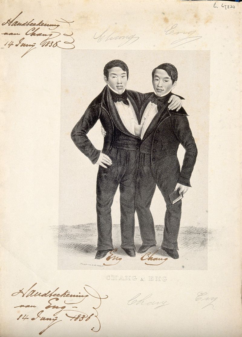 The World S Most Famous Conjoined Twins The Ones Who Gave Us The Term Siamese Twins The
