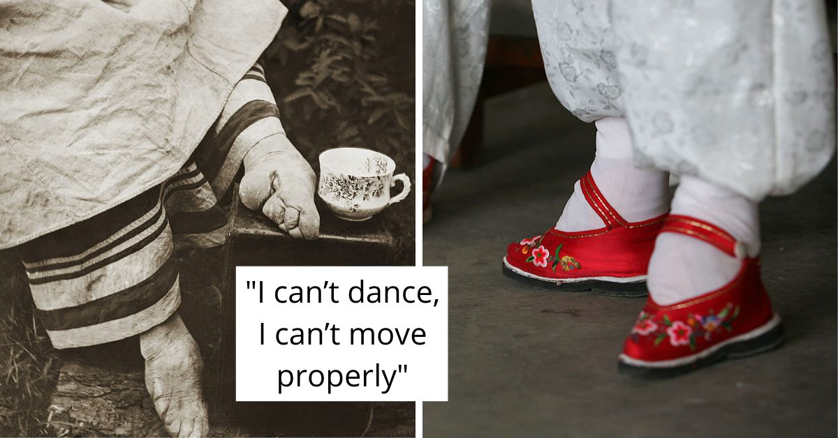 Chinese Foot Binding - The Excruciating and Dangerous Female Fashion Trend