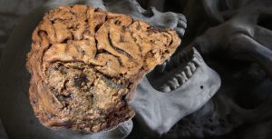 Preserved brain