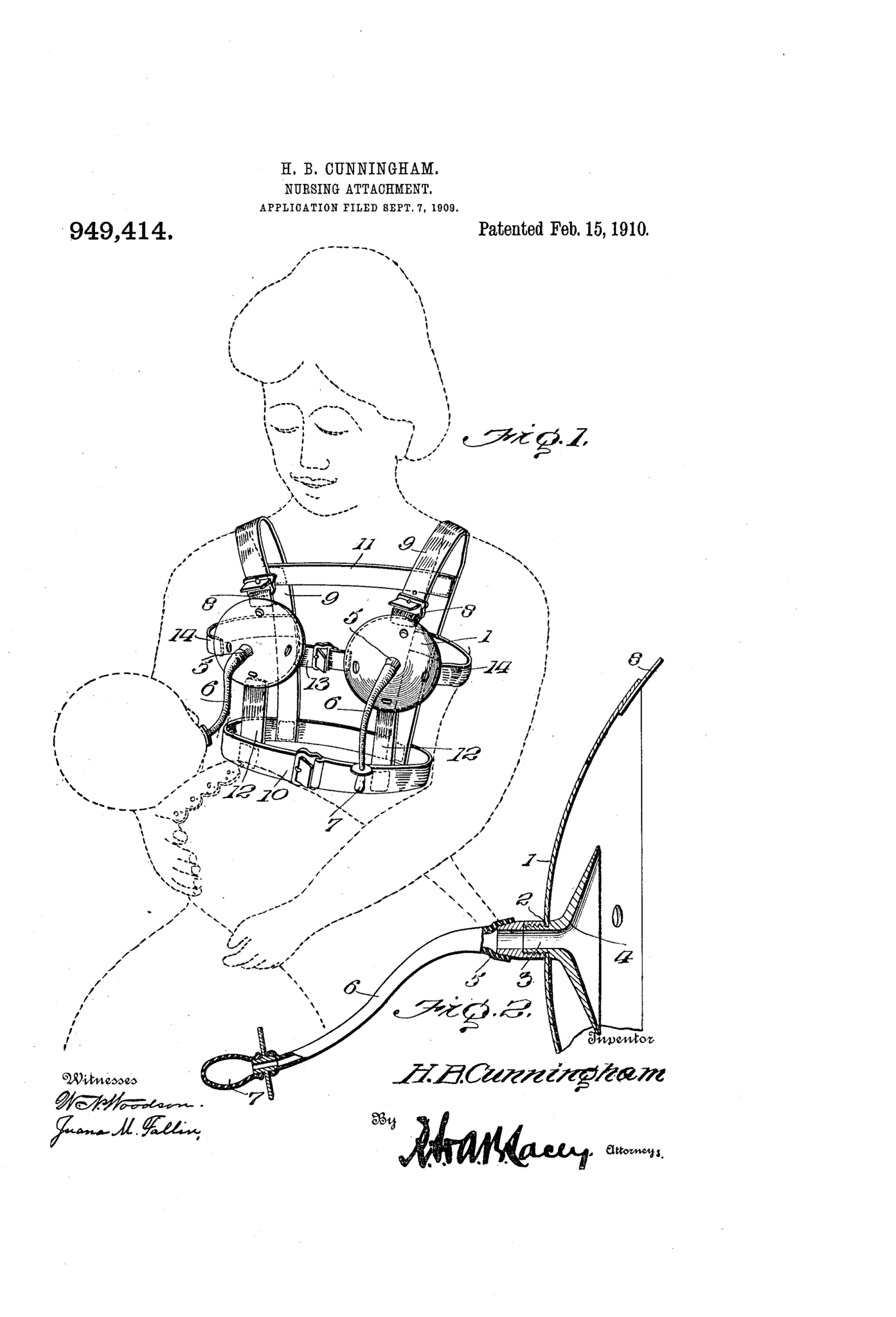 The Breast Pump Has Sucked for Centuries | The Vintage News