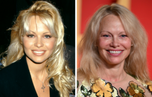 Headshots of Pamela Anderson before and now.