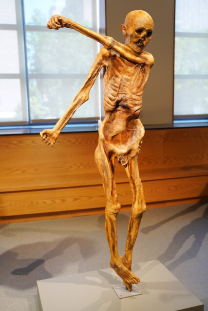 A mummified body standing on display, its left arm crossed to the right side.