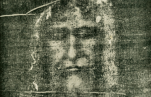 The head on the Shroud of Turin.